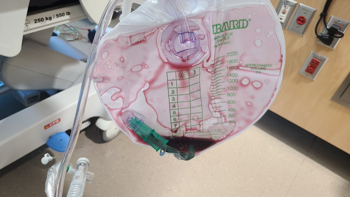 Steve Curry (@stevecurrymd) on Twitter photo 54 YO man presented with coma, metabolic acidosis, lactate 24 mEq/L. What drug did fellow give in treatment? (Easy one) <a href="/ToxAndHound/">The Tox And The Hound</a> #FOAMtox 54 YO man presented with coma, metabolic acidosis, lactate 24 mEq/L. What drug did fellow give in treatment? (Easy one) <a href="/ToxAndHound/">The Tox And The Hound</a> #FOAMtox