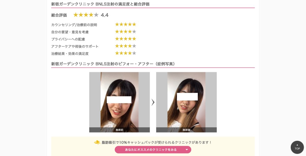 toquna_cashback's tweet photo. 「新宿ガーデンクリニック BNLS注射」の口コミと評価が投稿されました!
https://t.co/4mjPvqWXS4
#トクーナ
#口コミ
#美容整形
#整形垢さんと繋がりたい
#BNLS
#BNLS注射 https://t.co/zsyH6jU1Jt