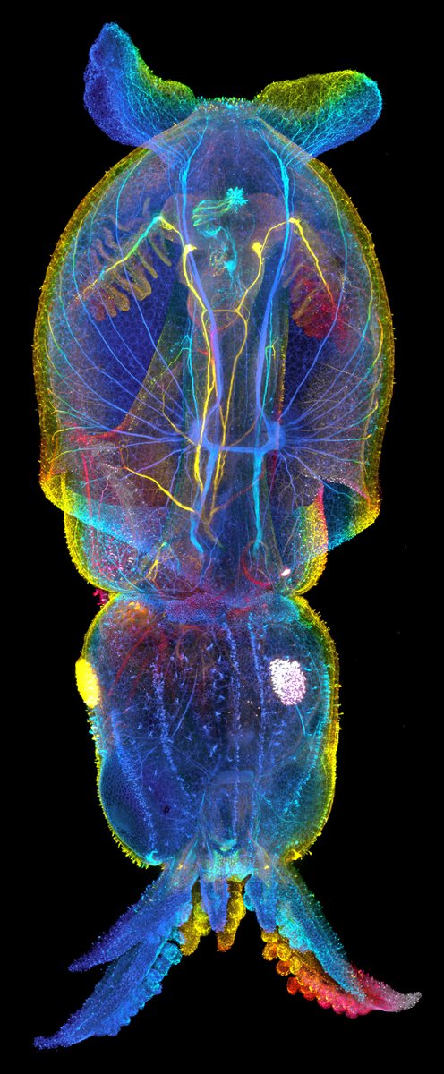 The nervous system of a juvenile squid

Credit: Nat Clarke

#neuroscience #neurotwitter #neurology #science #sciencetwitter #medtwitter #Bioinformatics #biochemistry #biotechnology #anatomy #neuroanatomy