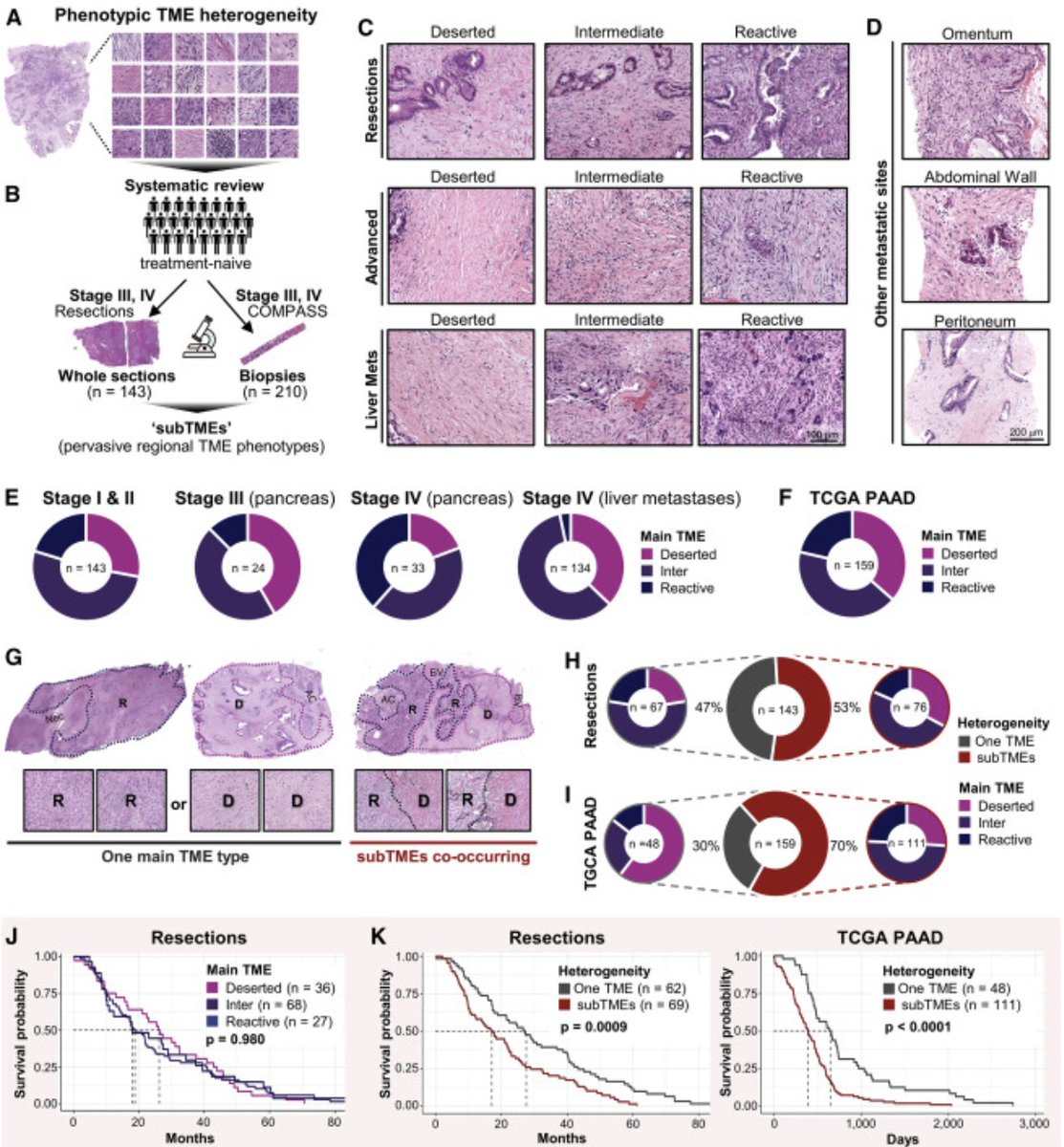 Check out this article by Barbara Grünwald et al. @pmcancercentre where the authors use histology-guided multiOMICS to characterize sub-tumor microenvironments. tinyurl.com/2p8e7nkr #TeachableTuesday @Kazeera2 
@c_mccloskey1
@PMResearch_UHN
@rmkhokha