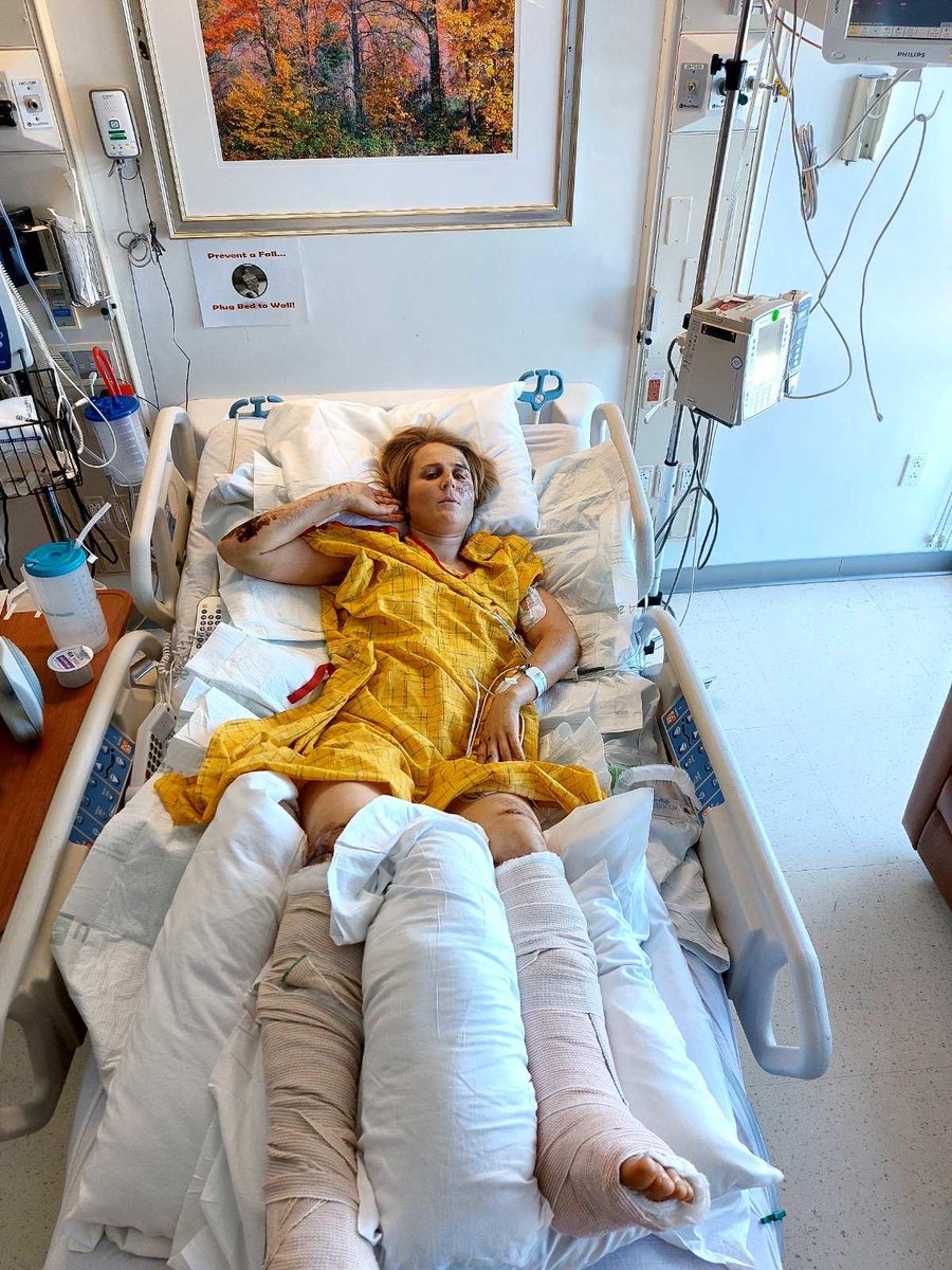 _seachange's tweet photo. Anna Parsons, a Marine Sci student I've taught @otago had a REALLY serious climbing accident in the USA. Anna's medical bills are though the roof, even with insurance. Please check out her story, and donate via https://t.co/LyKYyXLwEd

https://t.co/hLNvx0KplC https://t.co/bTLbOl6KRW