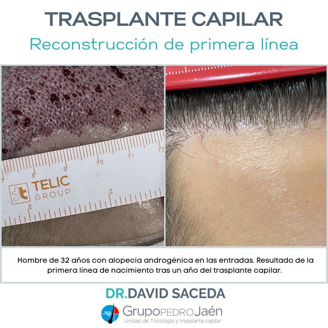 David Saceda Corralo tweet media