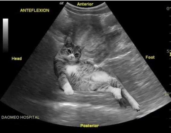 o senin cocugun degil diyenlere gösterdigim röntgen🥰