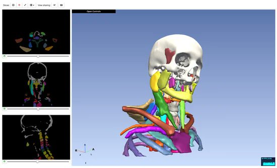 InformaticsMDPI's tweet photo. #HighlyCitedPaper

Modern Scientific #Visualizations on the Web 
By Prof. Daniel Haehn and @lorainefranke, from @UMassBoston, USA

Access for free: https://t.co/ZLNrFIAwy9

#ViSUS #XML3D #ParaViewWeb #JavaScript https://t.co/jU5DTszzkJ