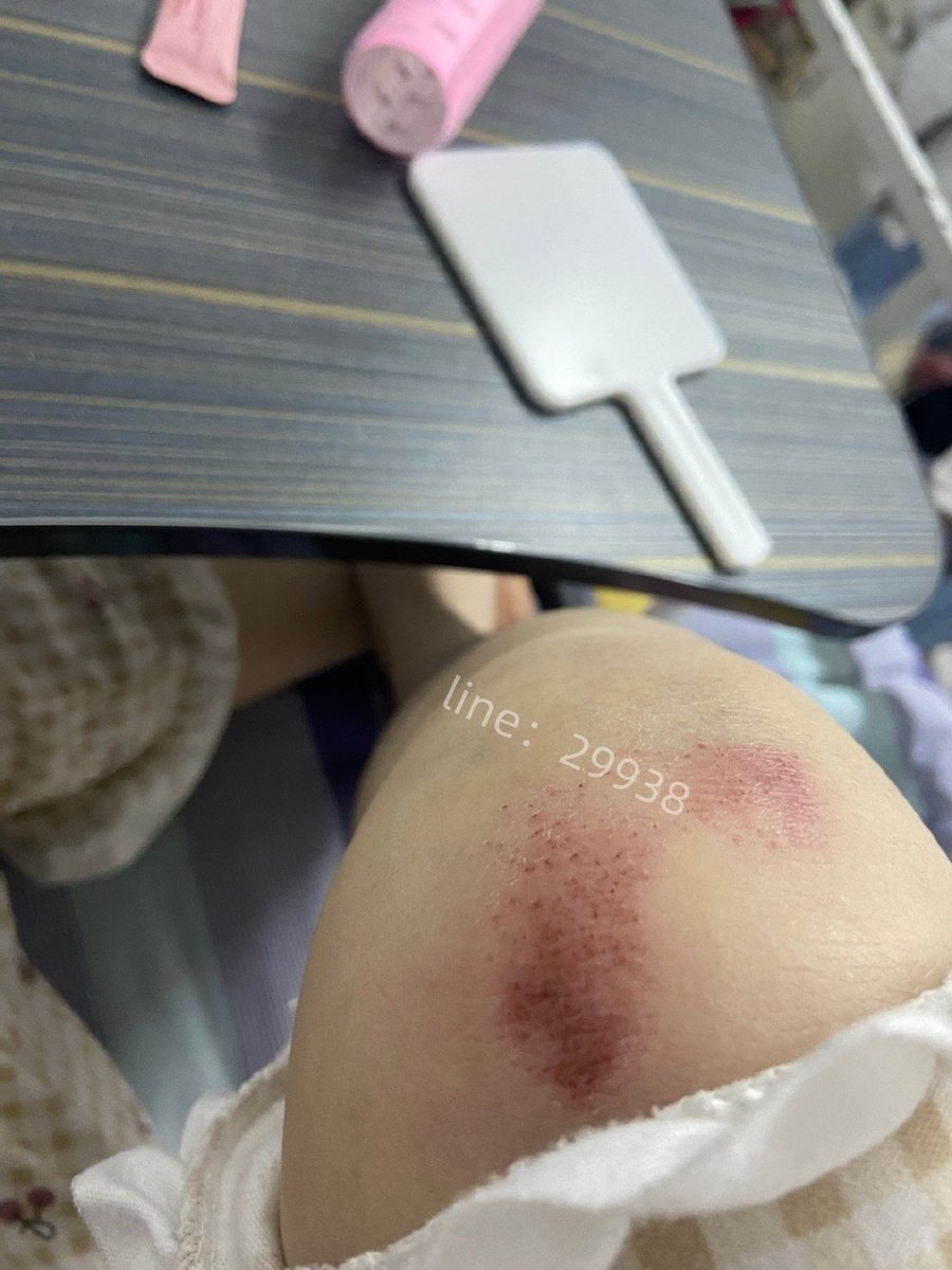 qq3132020's tweet photo. 哥哥 糰子痛痛可以給我呼呼嗎🥹🥹 https://t.co/dbRjBH7grf