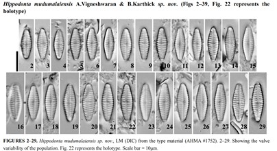 karthickbala's tweet photo. A new species of 𝐻𝑖𝑝𝑝𝑜𝑑𝑜𝑛𝑡𝑎 Lange-Bertalot, Metzeltin &amp; Witkowski (Bacillariophyceae, Naviculales) from the Western Ghats, India by @Vikeyanbu @WadmareNeha  https://t.co/4AK47fCa7w https://t.co/CIcD4d7kXv