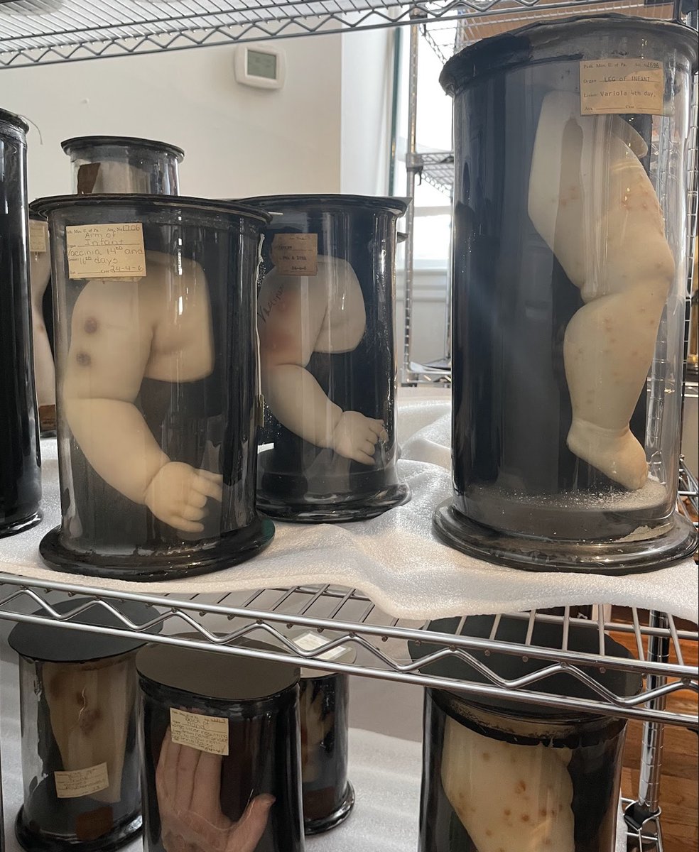 If you've been to the Museum recently, you have likely seen our Collections team working with wax models. These models show the progression of smallpox infection or vaccination. In honor of #ImmunizationAwarenessMonth, learn more about them on our Facebook and Instagram posts.