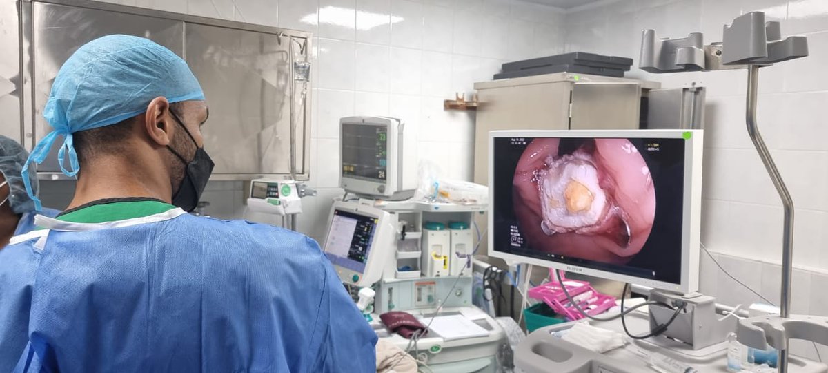amckenzieMD's tweet photo. En el Servicio de Gastroenterología del CHDrAAM realizamos de forma ambulatoria la resección endoscópica de un adenocarcinoma de recto en una paciente no candidata a cirugía, utilizando por primera vez en Panamá el dispositivo de resección transmural OVESCO FTRD. https://t.co/J4mhE7Wp9P