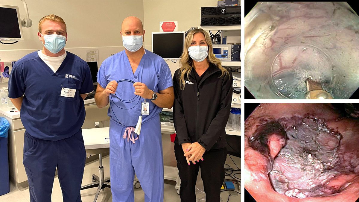 CreoEndoscopy's tweet photo. 🇺🇸 Congratulations to @FarisMuradMD, who is making rapid progress on the Pioneer Clinical Education Program! 

Two successful cases already performed:
▶️ 8cm gastric lesion
⏩ 3x5 GIST

"I am so excited about the technology and growing a training center in Chicago." https://t.co/8qczc140qs