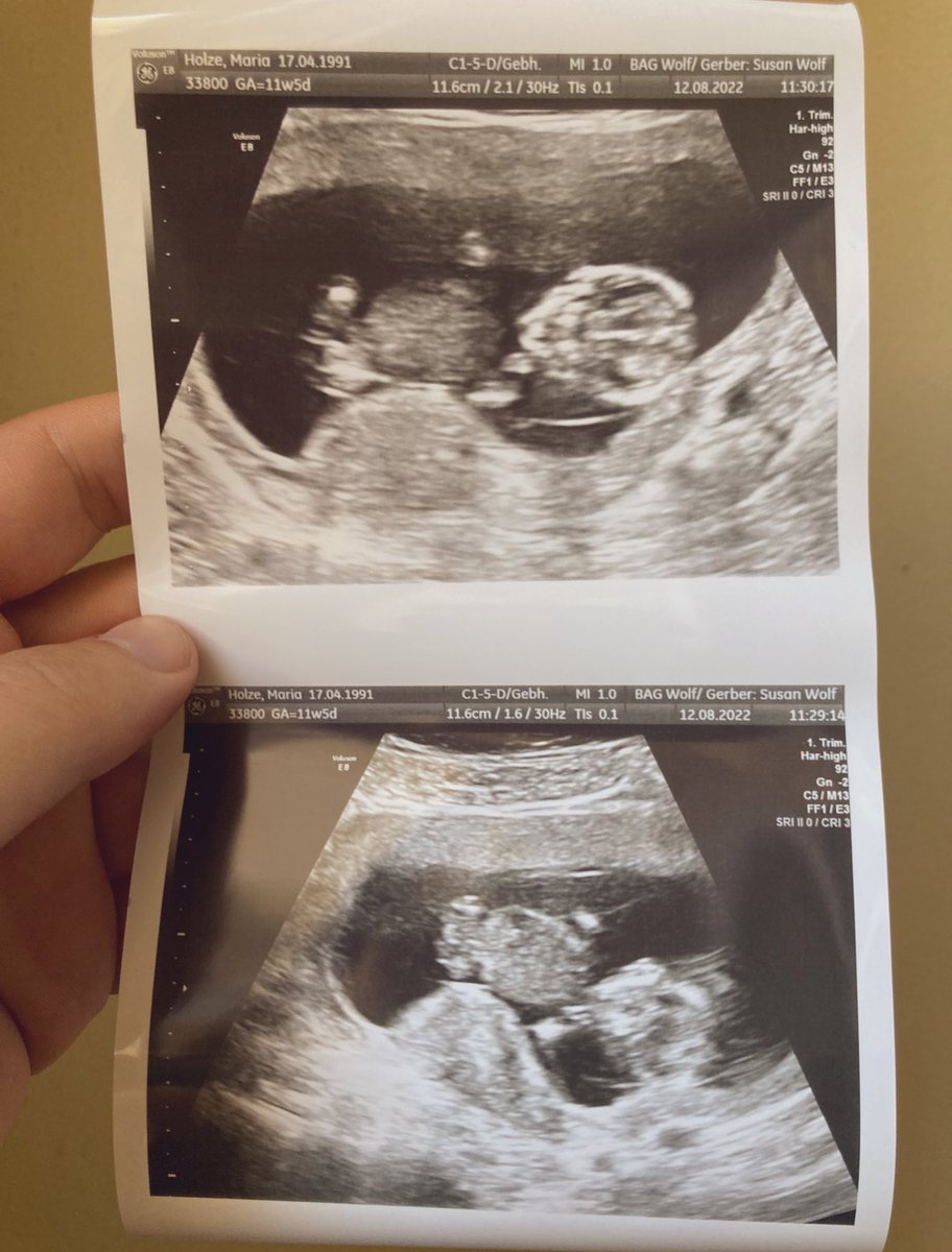 Markus "BonK" Bonk tweet media