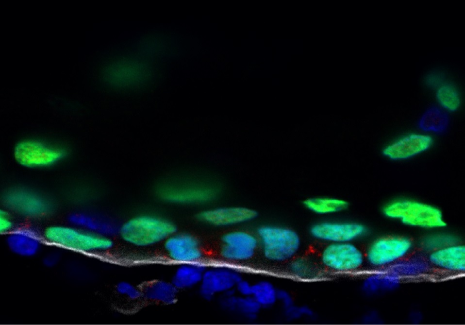 PLOSBiology's tweet photo. #MitoticSpindle orientation and symmetric vs asymmetric #CellDivision govern cell fate &amp; tissue morphogenesis. @TheLuxLabTau shows that #apoptosis functions as an external cue that enhances symmetric cell division in the developing #epidermis #PLOSBiology https://t.co/xXEpKp8tEK https://t.co/3NrIDAVgKN