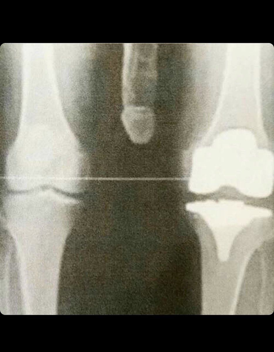 TEAMBEASTW's tweet photo. SUCCESSFUL SCAN!

Team Beasts right winger and luxury player @NabeastKeita’s knee injury is not serious, as first expected and reported. 

You can see him in action already tonight, when our our E-sports team take on Div 1 in Pro Clubs! https://t.co/S2UCC2AULj