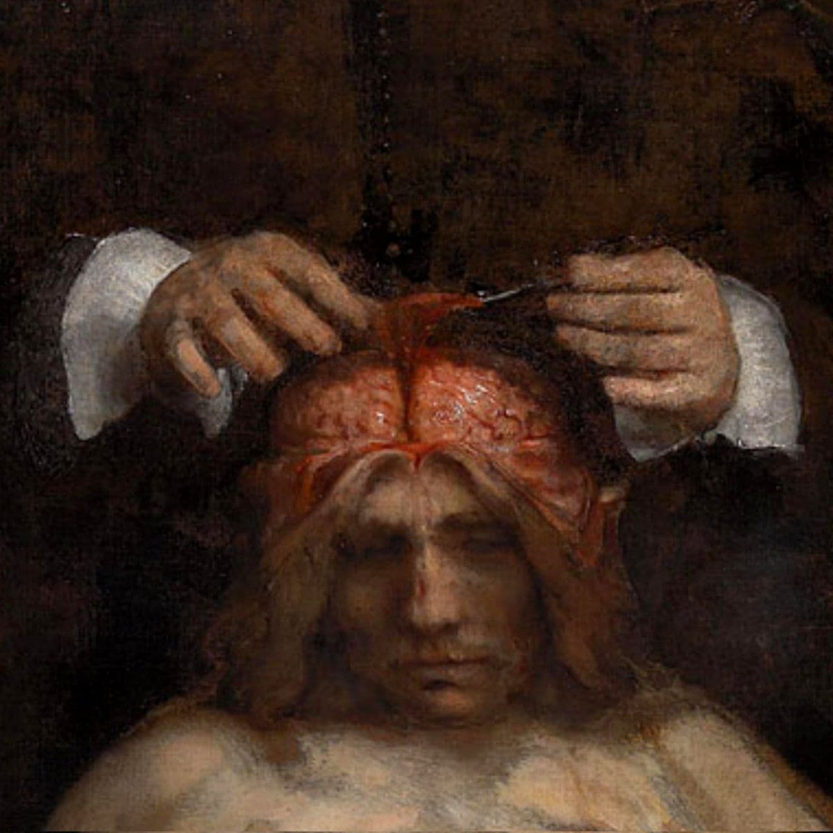 the anatomy lesson of dr deijman by rembrandt