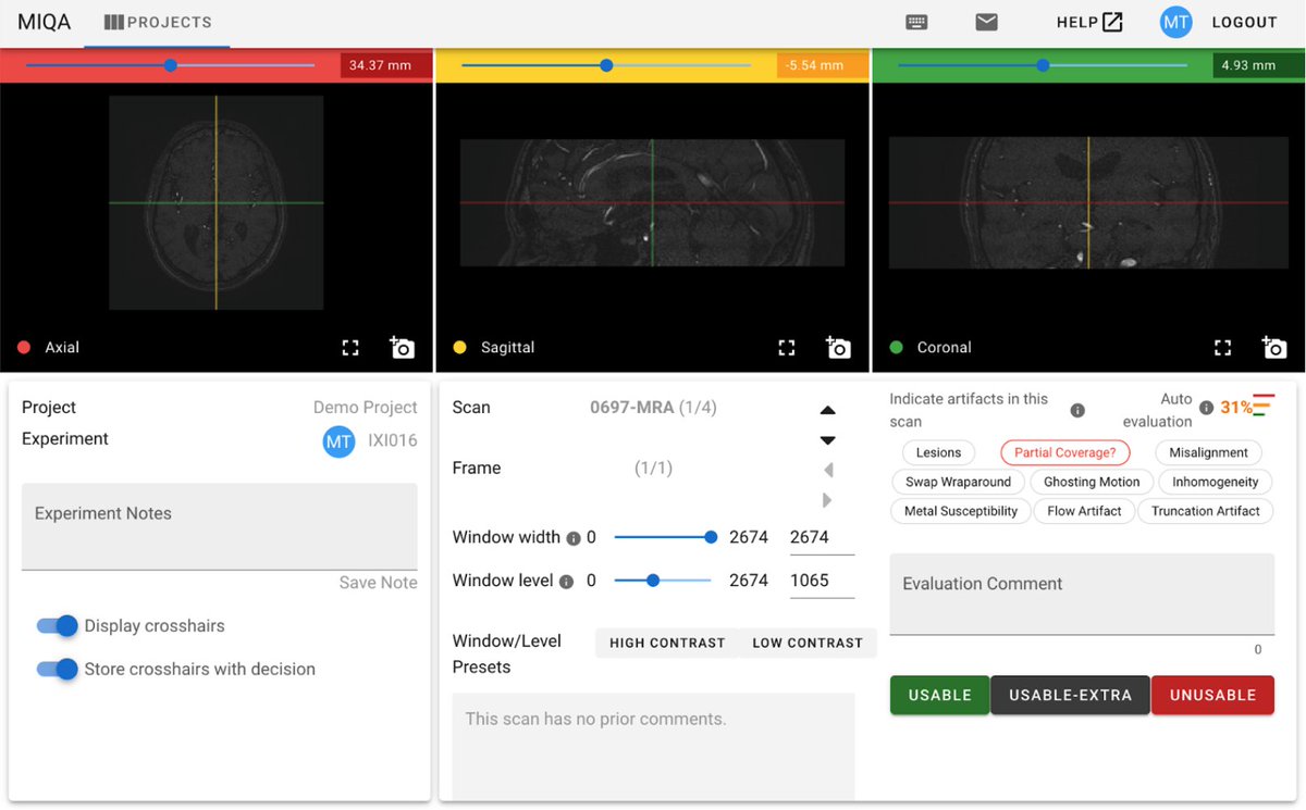 Kitware's tweet photo. We're excited to launch MIQA, a cloud-based #medicalimaging application that leverages modern UI/UX and deep learning techniques for efficient and accurate QC processing. Being #opensource, it can be extended and customized for research or commercial use https://t.co/pWTFwf2nFR https://t.co/DC57h2piIA