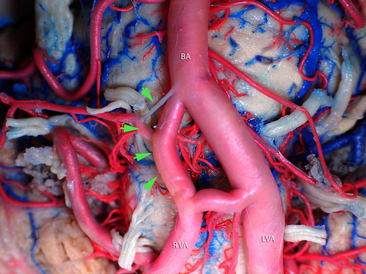 Neurosurgical Anatomy tweet media