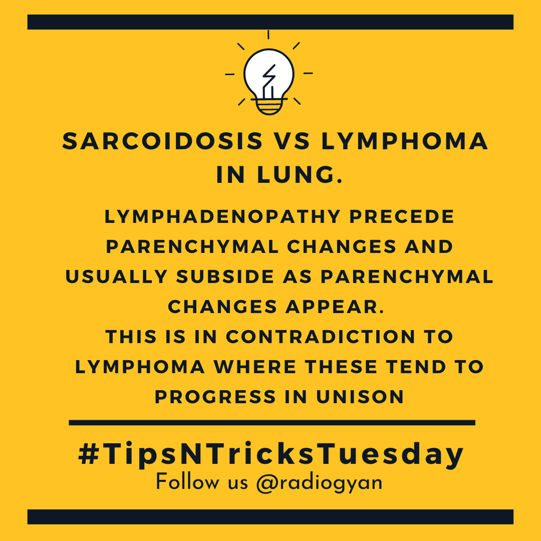 TeamRadioGyan's tweet image. #TipsnTricksTuesday

Here is a pearl about Sarcoidosis vs Lymphoma In lung
 
All credits to #TeamGyan member Dr. Dev.
Follow him on Instagram @drdevrad for more.
 
#sarcoidosis #hrct #radiogyan  #study #learning #radiology #radiologist #radtech #radiologylove #imaging