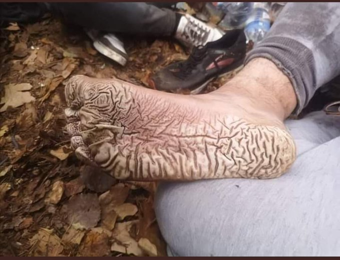 masumlaravuslat's tweet image. İnsani şartlarda yaşama umuduyla yollara düşen ve bunun için ölümü dahi göz alan insanlara, kurtulunması gereken “yük” muamelesi yapmak ve geri itmek ne insanlığa ne de vicdana sığar. @UNmigration

#Endpushbacks