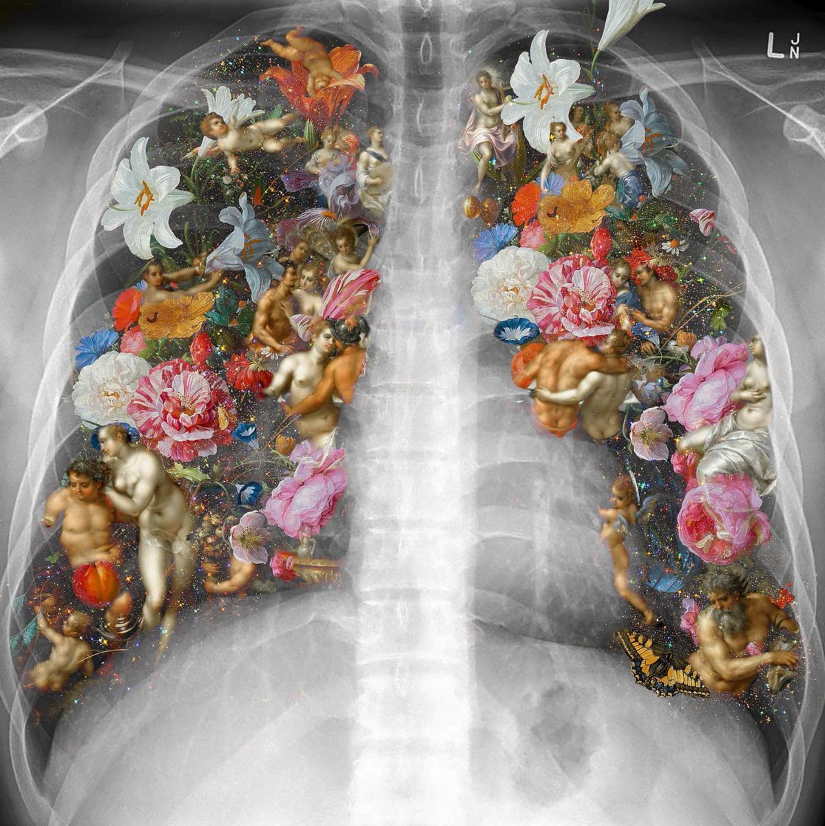 SeaSaltTherapy's tweet photo. LUNG FACTS!

Did you know that when you breathe, 70% of waste is eliminated in the form of waste gases like carbon dioxide? 

#lungfacts #healthfacts #didyouknow #didyouknow #facts #factsdaily #funfacts #funfactsoftheday #justbreathe #inhale #lungs #respiratory #seasalttherapy https://t.co/w6prdi5mws