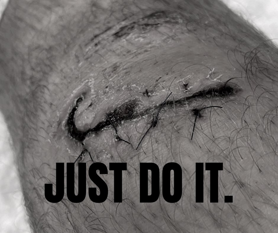 teeko_gg's tweet photo. Why does my wound look like @Nike 💀 https://t.co/AfwUw1HV3t