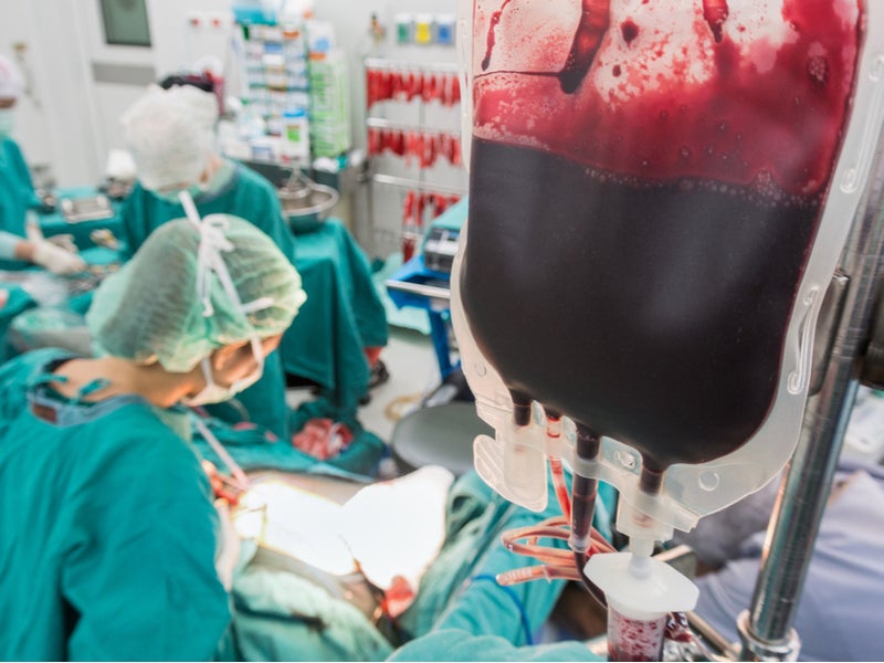 fabrice_hak's tweet photo. In blood donation only one pauche is taken from a donor, but during surgery a patient can need three even more pauches of blood. Out here people need to be saved and there is always a possibility that a patient is saved buy more than one or two donors. #letsavelives
#medblazon https://t.co/j5grtbN7p6