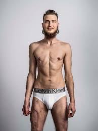 AngieDues61's tweet photo. This is what it looks like; mastectomy, hysterectomy, fake penis made from her thigh meat. Woman to trans man https://t.co/39POi7T0bt