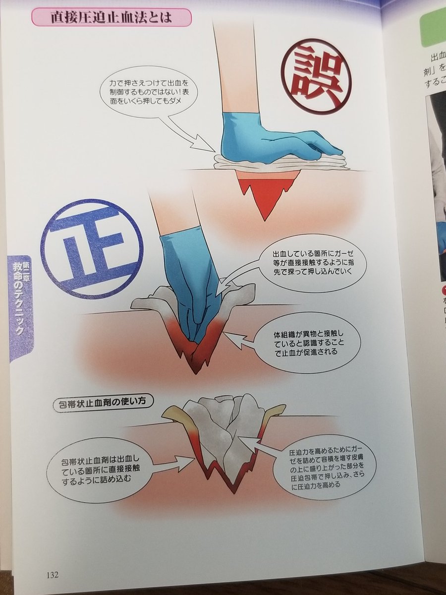 閲覧注意 戦闘時の外傷の正しい救護方法が イタタタタタ ってなる 痛そう ねじ込むのか Togetter