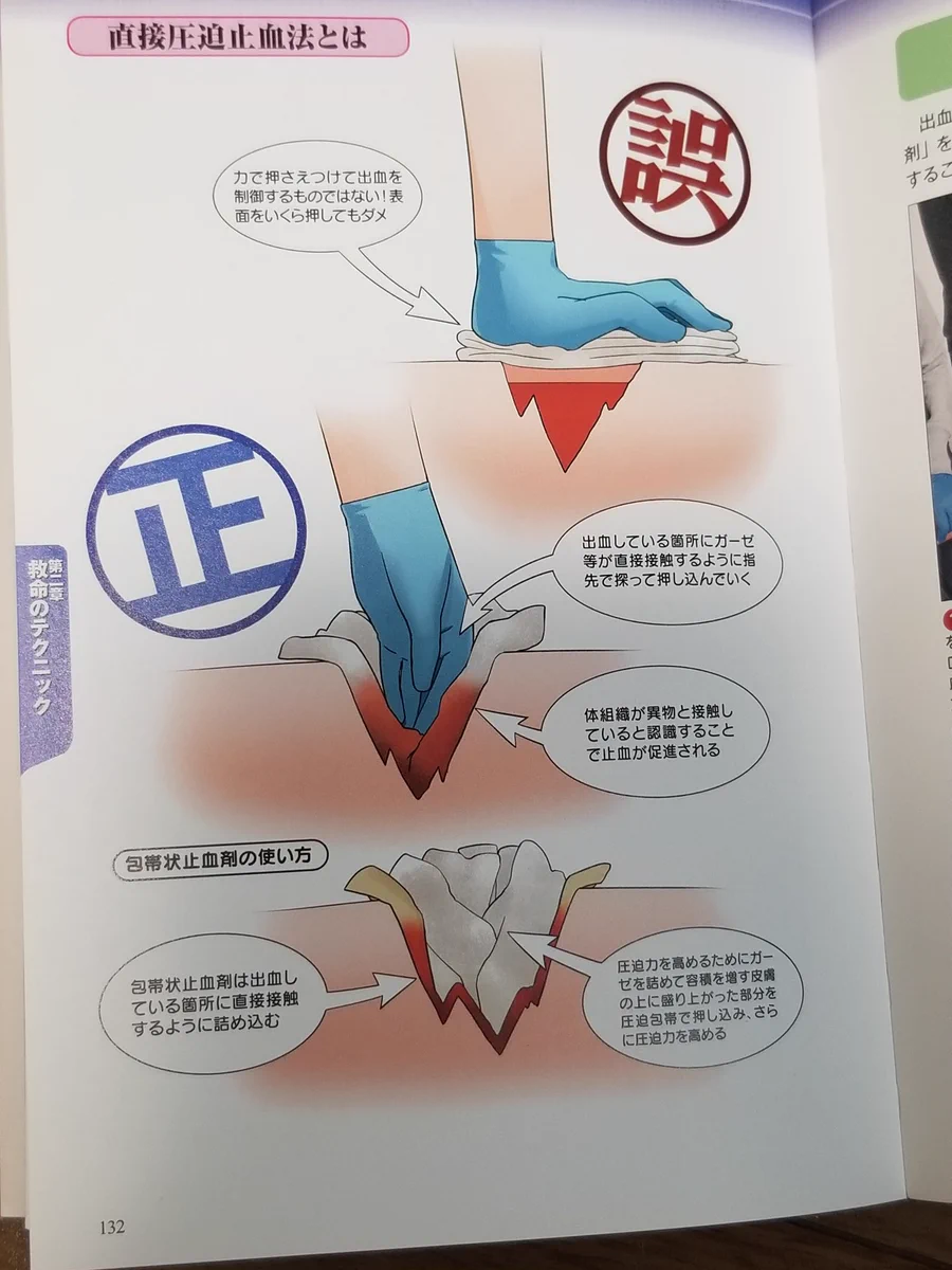 圧迫止血の方法が思ったのより激しい！大きな怪我の時は思い切ってやろう！