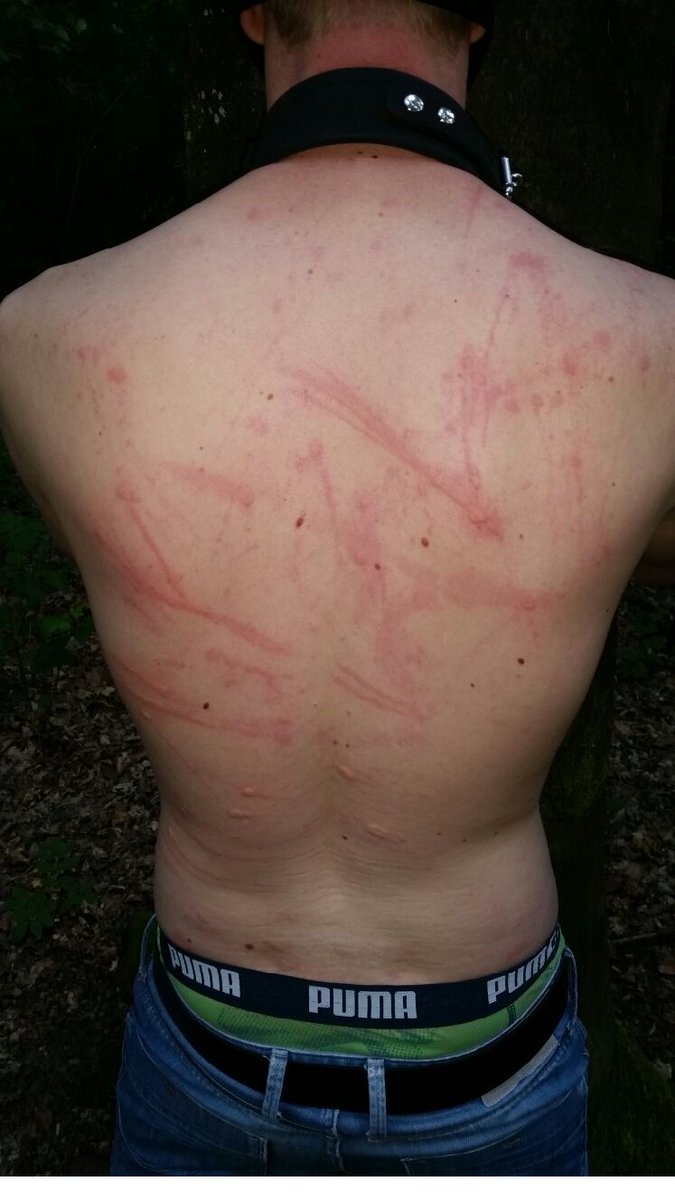 FemdomCuck's tweet photo. Long time ago, Public #BDSM #Whipping in the Woods #Pain #Marks https://t.co/20wPCyaWV2