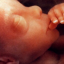 BothLives's tweet photo. What sort of society accepts as sacred the termination of one human being by another?

Progress is surely meant to take us to a better place. Is better not where every human being is valued, respected, enabled and protected? 2/2

#BothLivesMatter #stand4both #factsnotideology https://t.co/M3xvFG1en5