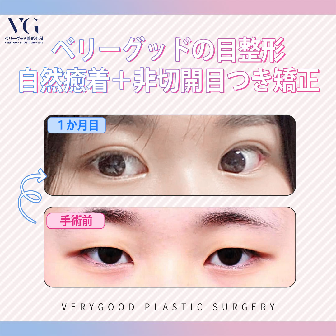Vgベリーグッド美容整形外科 Vgprsj Twitter