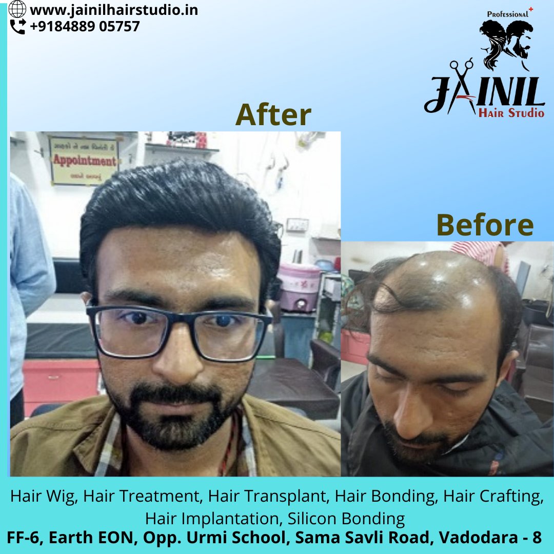 HairJainil's tweet photo. ainil Hair Studio Vadodara best Hair Wig &amp; Hair Treatment, hair Fixing, Hair weaving, Bonding &amp; grafting for Men, Hair Implementation, Silicon Bonding. 
Call us or WhatsApp us on 8488905757  
https://t.co/ra847Ckesa
#hairrebonding #hairfixing #hairstudiovadoadara #hairgrafting https://t.co/OJksMKO1SZ