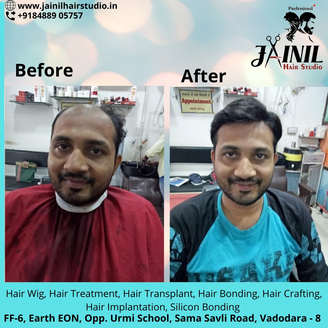 HairJainil's tweet photo. Jainil Hair Studio Vadodara best Hair Wig &amp; Hair Treatment, hair Fixing, Hair weaving, Bonding &amp; grafting for Men, Hair Implementation, Silicon Bonding. 
Call us or WhatsApp us on 8488905757  
https://t.co/ra847Ckesa
#hairrebonding #hairfixing #Vadodara #haircarecenter https://t.co/C0Nv7bSN7b