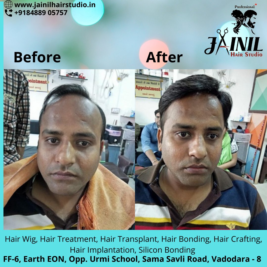 HairJainil's tweet photo. Jainil Hair Studio Vadodara best Hair Wig &amp; Hair Treatment, hair Fixing, Hair weaving, Bonding &amp; grafting for Men, Hair Implementation, Silicon Bonding. 
Call us or WhatsApp us on 8488905757  
https://t.co/ra847Ckesa
#hairrebonding #hairfixing #hairstudio #Vadodara
#hairgrafting https://t.co/QoTG4BeDnw