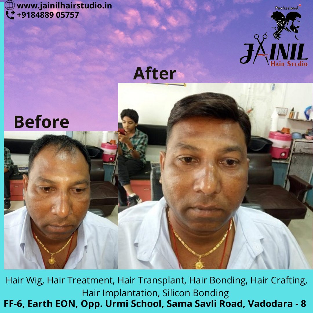 HairJainil's tweet photo. Jainil Hair Studio Vadodara best Hair Wig &amp; Hair Treatment, hair Fixing, Hair weaving, Bonding &amp; grafting for Men, Hair Implementation, Silicon Bonding. 
Call us or WhatsApp us on 8488905757  
https://t.co/ra847Ckesa
#hairrebonding #hairfixing #Vadodara #hairgrafting https://t.co/dsp3A7coLF
