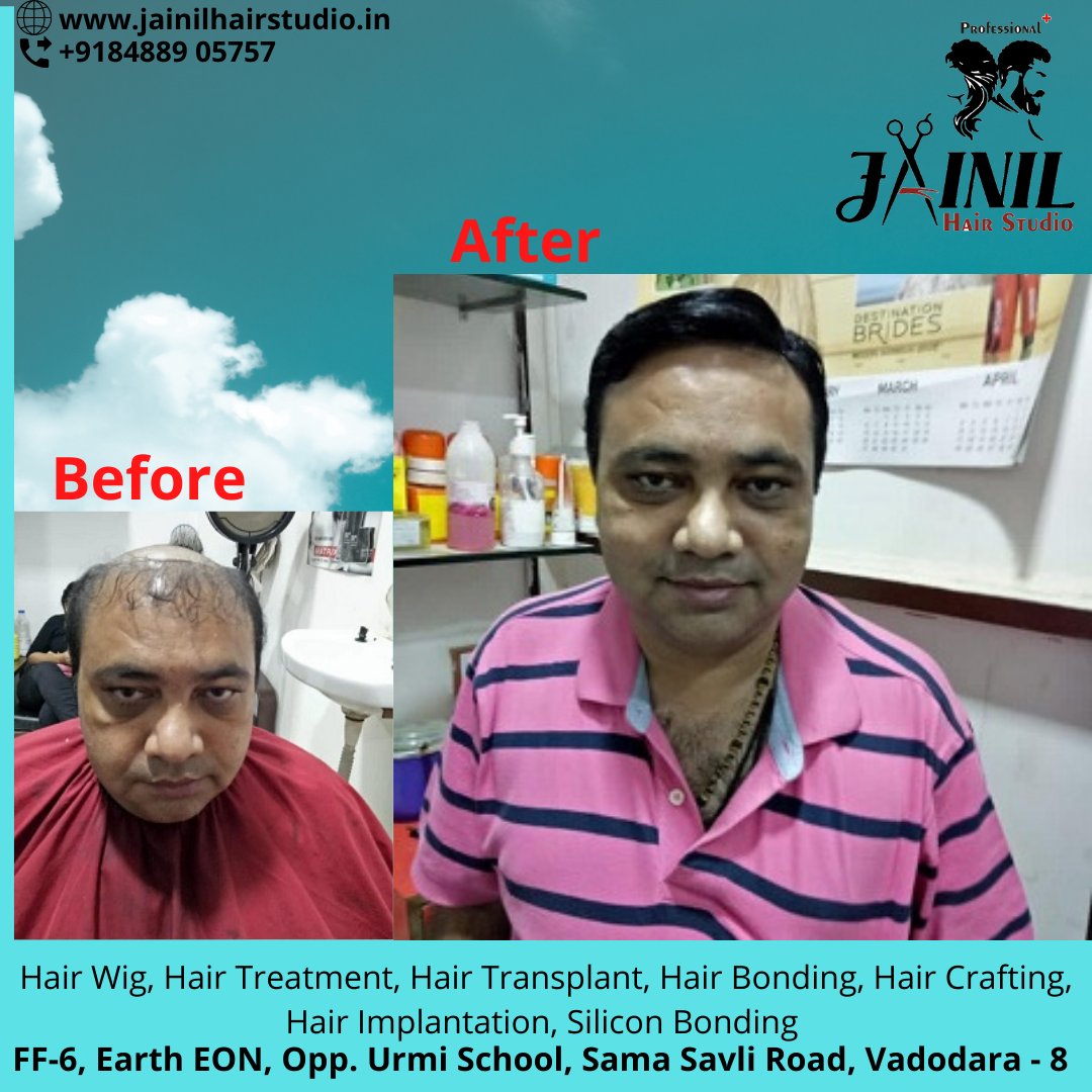 HairJainil's tweet photo. Jainil Hair Studio Vadodara best Hair Wig &amp; Hair Treatment, hair Fixing, Hair weaving, Bonding &amp; grafting for Men, Hair Implementation, Silicon Bonding. 
Call us or WhatsApp us on 8488905757  
https://t.co/ra847CBPQK
#hairrebonding #hairfixing #hairstudioinvadodara https://t.co/6NpBbRgllA