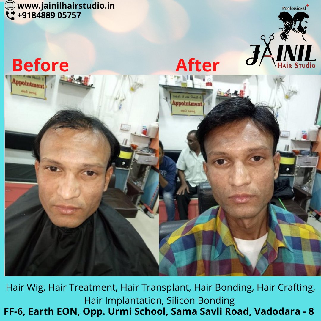 HairJainil's tweet photo. Jainil Hair Studio Vadodara best Hair Wig &amp; Hair Treatment, hair Fixing, Hair weaving, Bonding &amp; grafting for Men, Hair Implementation, Silicon Bonding. 
Call us or WhatsApp us on 8488905757  
https://t.co/ra847Ckesa
    #hairstudio#haicare#vadodara
#hairgrowth https://t.co/Q0HAru34ox