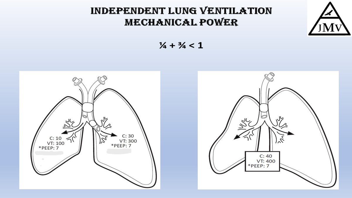 OfVentilation's tweet photo. Mechanical Power: New insight for Independent Lung Ventilation Coming next issue September in the Journal of Mechanical Ventilation https://t.co/K2M02ne0PA