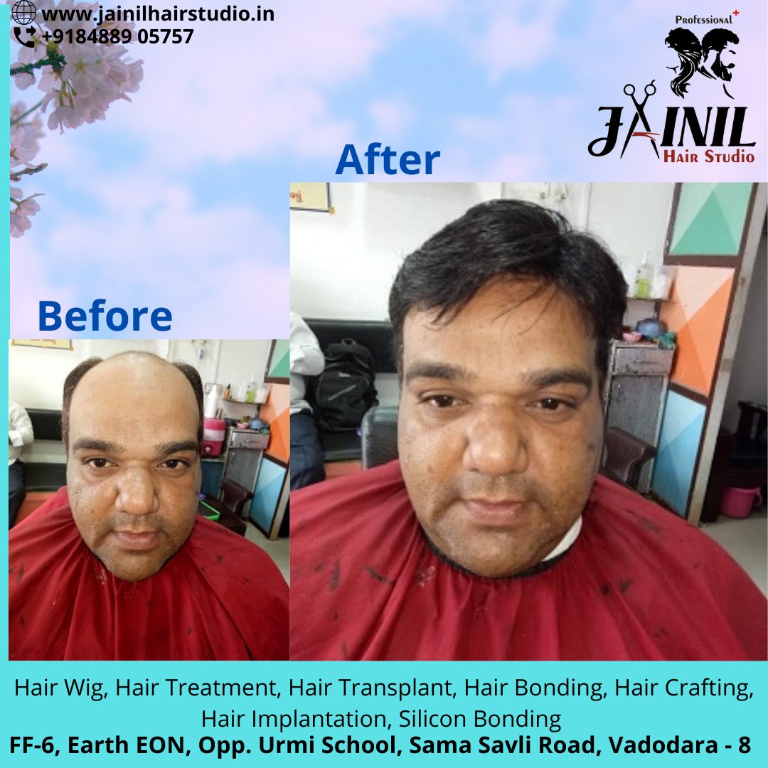 HairJainil's tweet photo. Jainil Hair Studio Vadodara best Hair Wig &amp; Hair Treatment, hair Fixing, Hair weaving, Bonding &amp; grafting for Men, Hair Implementation, Silicon Bonding. 
Call us or WhatsApp us on 8488905757  
https://t.co/ra847Ckesa
#hairrebonding #hairfixing #siliconbonding #haircare 
#Vadodara https://t.co/iA8X9EIZkZ