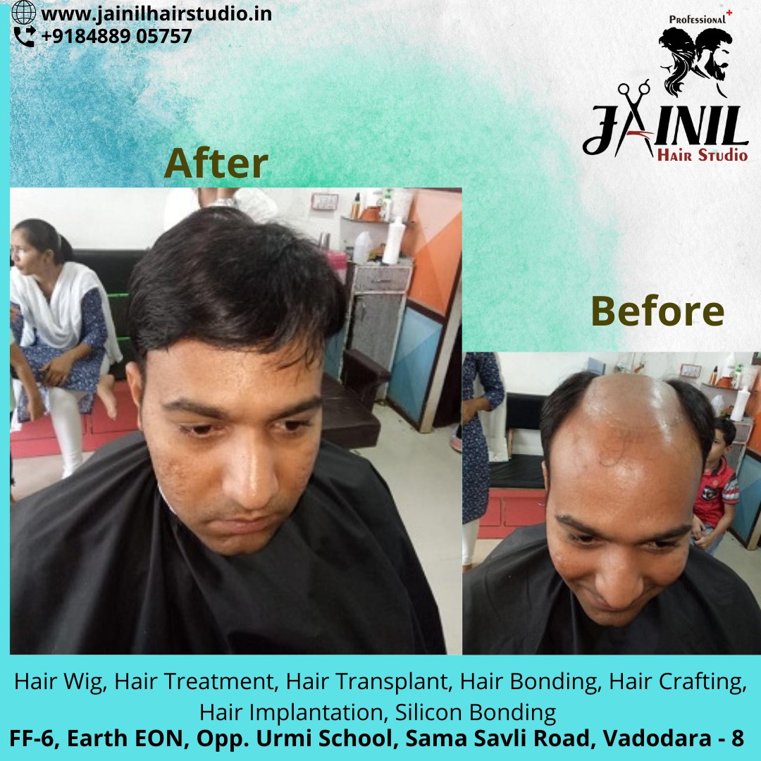 HairJainil's tweet photo. Jainil Hair Studio Vadodara best Hair Wig &amp; Hair Treatment, hair Fixing, Hair weaving, Bonding &amp; grafting for Men, Hair Implementation, Silicon Bonding. 
Call us or WhatsApp us on 8488905757  
https://t.co/ra847Ckesa
#hairrebonding #hairfixing #hairstudioinvadodara
#haircare https://t.co/XdkPxX4HQg