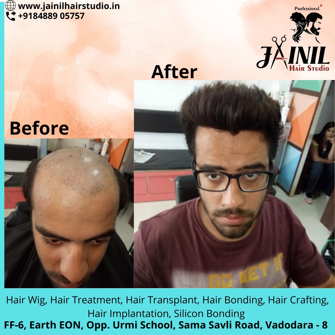 HairJainil's tweet photo. Jainil Hair Studio Vadodara best Hair Wig &amp; Hair Treatment, hair Fixing, Hair weaving, Bonding &amp; grafting for Men, Hair Implementation, Silicon Bonding. 
Call us or WhatsApp us on 8488905757  
https://t.co/ra847CBPQK
#hairrebonding #hairfixing #hairstudioinvadodara 
#baroda https://t.co/RV402cEVJD
