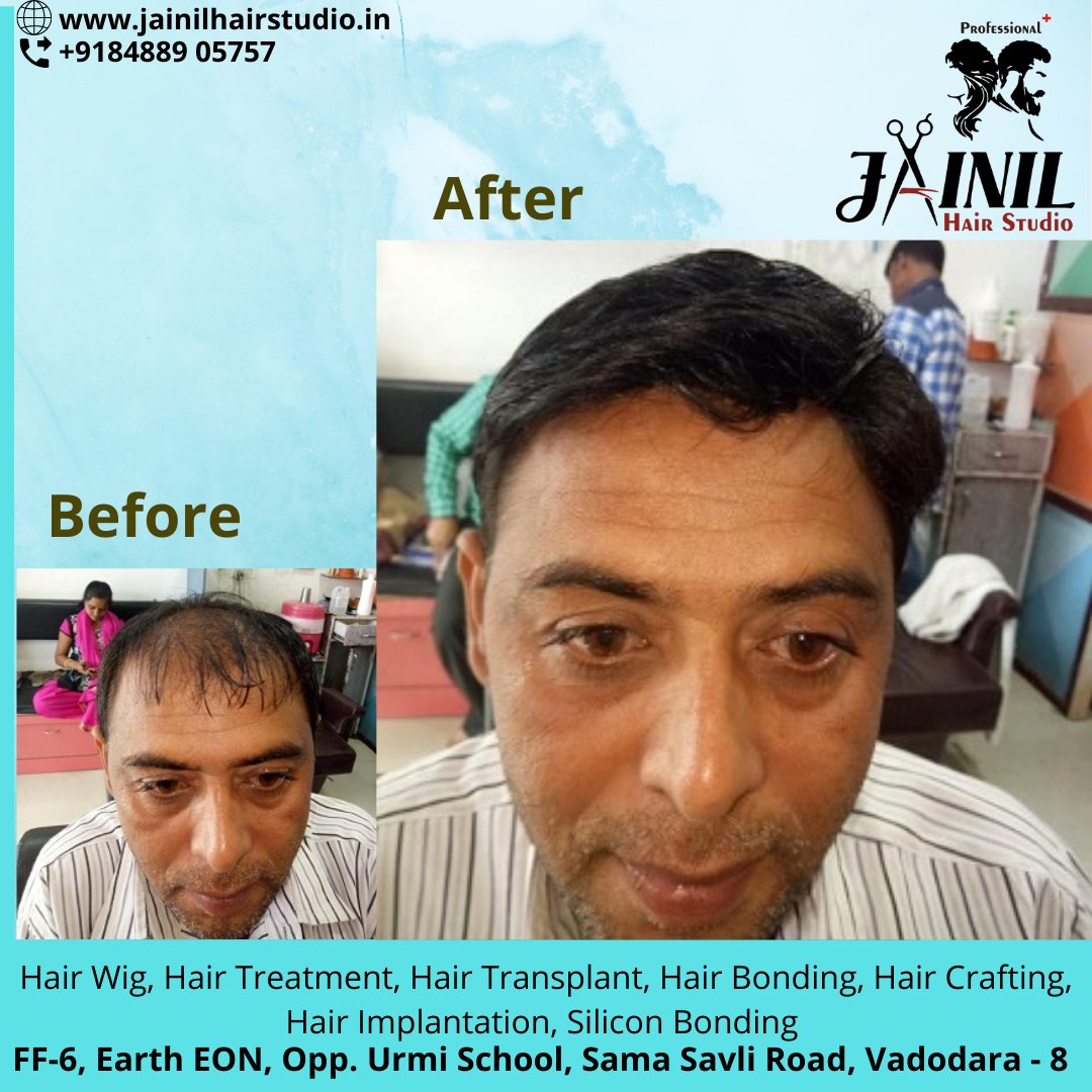 HairJainil's tweet photo. Jainil Hair Studio Vadodara best Hair Wig &amp; Hair Treatment, hair Fixing, Hair weaving, Bonding &amp; grafting for Men, Hair Implementation, Silicon Bonding. 
Call us or WhatsApp us on 8488905757  
https://t.co/ra847CBPQK
#hairrebonding #hairfixing #siliconbonding #baroda https://t.co/5WK6LuxjkC