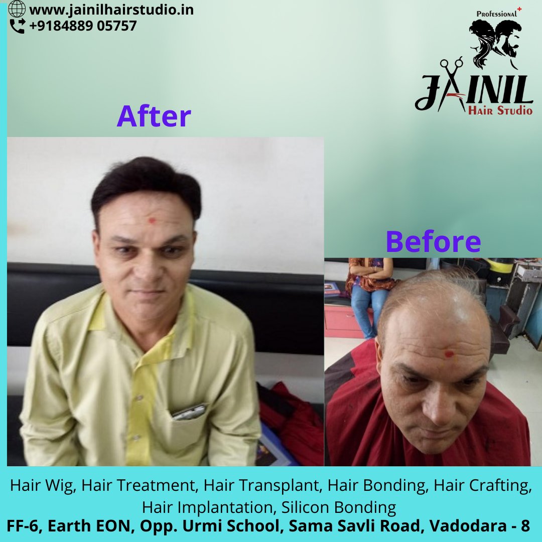 HairJainil's tweet photo. Jainil Hair Studio Vadodara best Hair Wig &amp; Hair Treatment, hair Fixing, Hair weaving, Bonding &amp; grafting for Men, Hair Implementation, Silicon Bonding. 
Call us or WhatsApp us on 8488905757  
https://t.co/ra847Ckesa
#hairrebonding #hairfixing #siliconbonding #hairgraftingforall https://t.co/EkfTIdIfaA