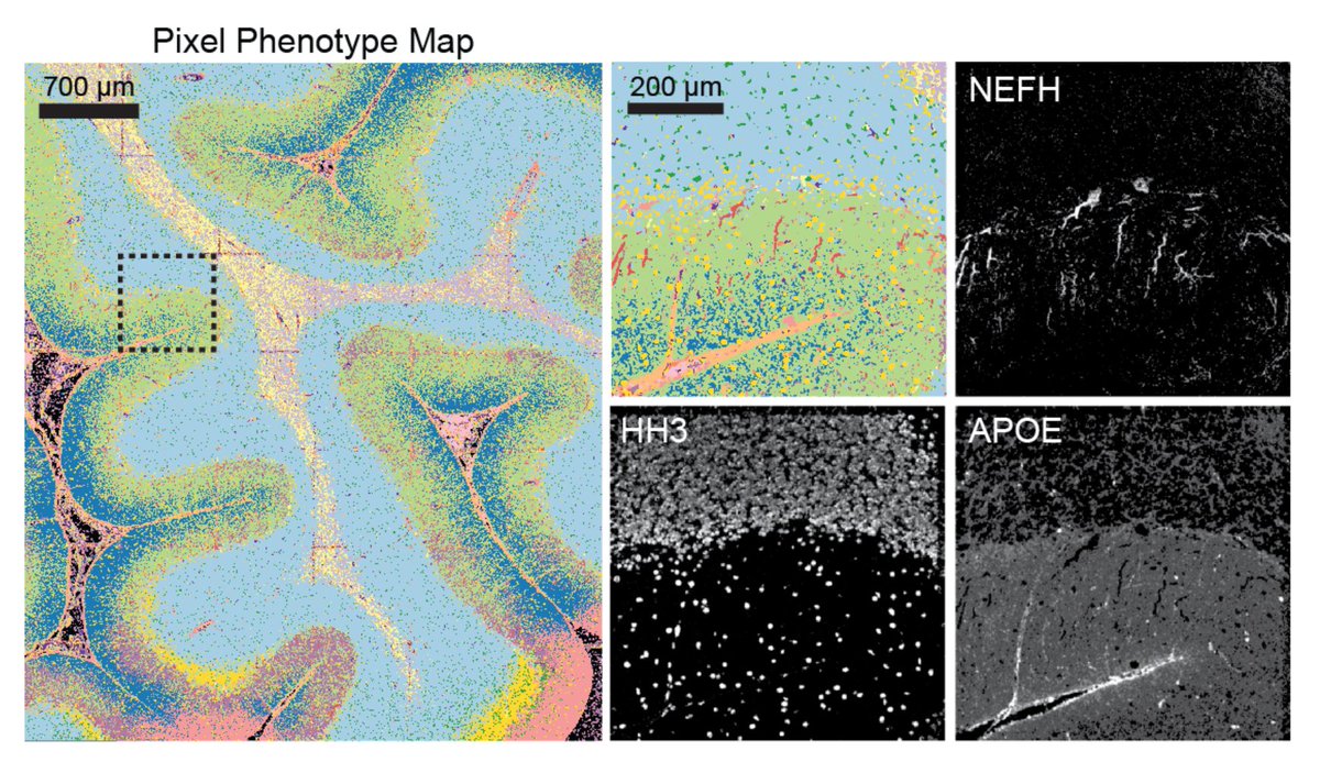 Due to abnormal shapes and complex spatial conformations of neuronal objects, cell segmentation is difficult in brain images. In beautiful MIBI images by <a href="/Dunja_Mrdjen/">Dunja Mrdjen</a>, Pixie was able to map the full neuronal landscape, including neurons, vessels, astrocytes, and microglia. [7/x]