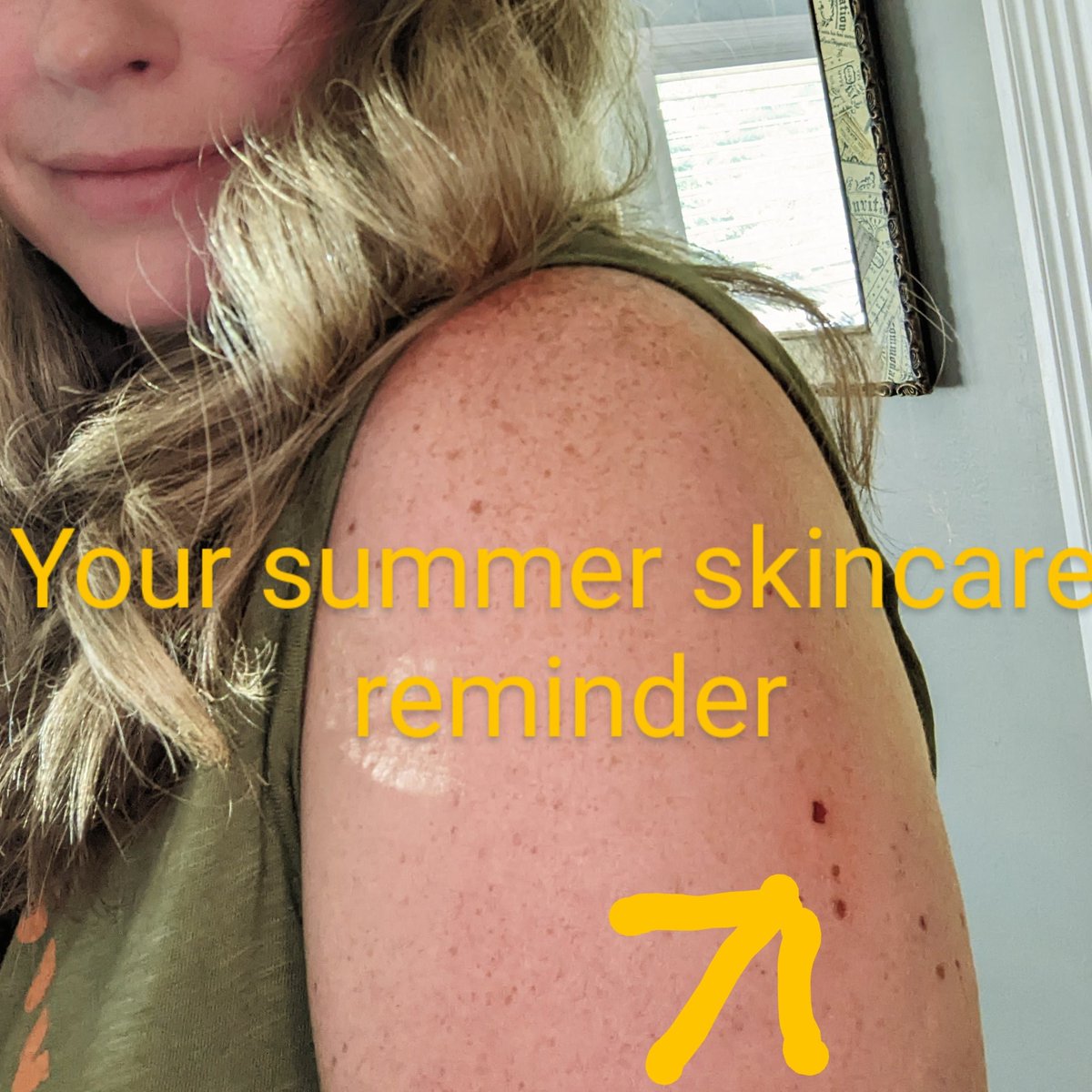 Life gets in the way and I haven't had my skin screened for about 3 years 😬. Thankfully only one spot this time and 🤞it is benign. Get your skin checked people!

#Cancerprevention #skincare #selfcare