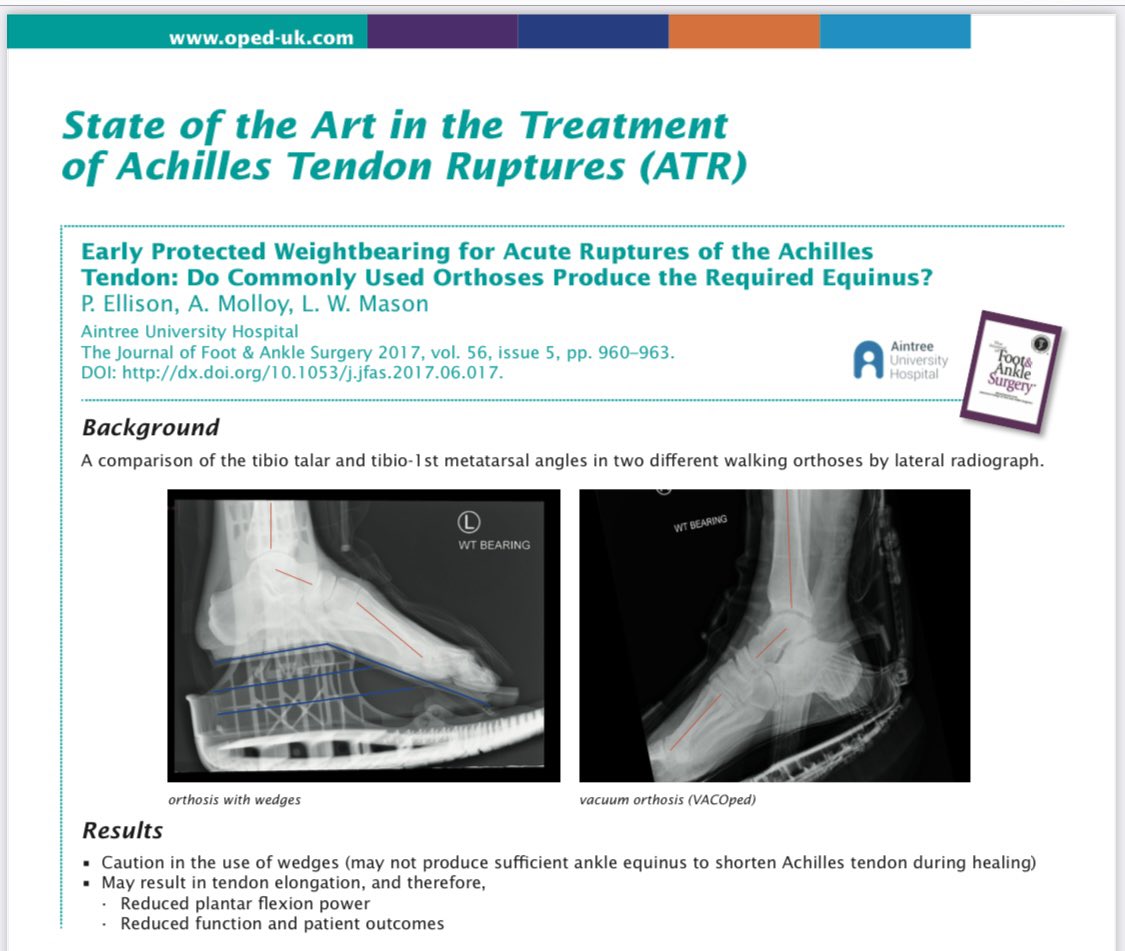 How do you treat your Achilles’ tendon ruptures? #achilles #atr #rupture #vacoped #footandankle #orthopaedic