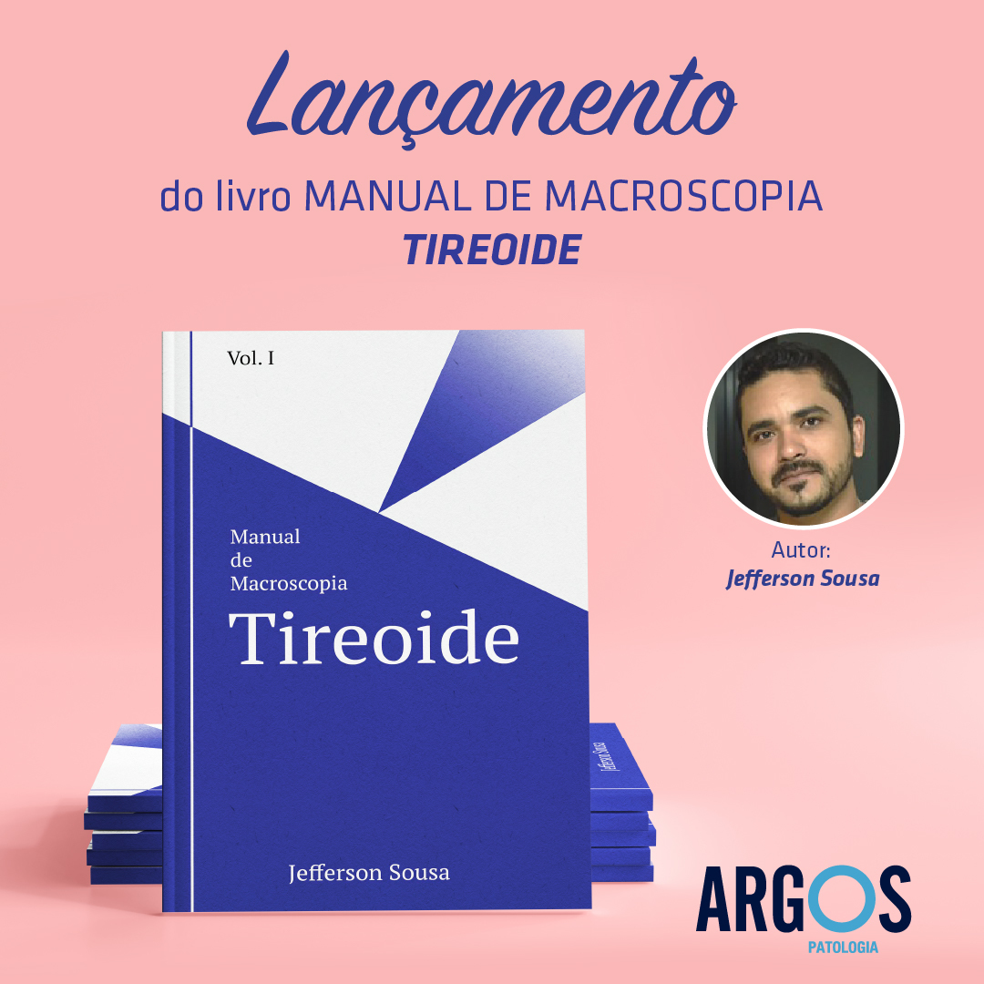 ArgosPatologia's tweet photo. O nosso colaborador Jefferson Sousa @jefferson_sousajbs é autor do livro MANUAL DE MACROSCOPIA - TIREOIDE que terá seu lançamento no Laboratório Argos para convidados.
✅O livro já está disponível na Amazon (https://t.co/lixK9LPTHZ).
#macroscopia
#argospatologia https://t.co/fBDsonr0QU