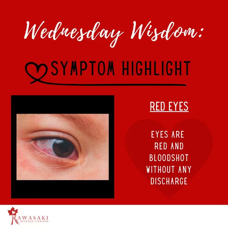 KawasakiDisCan's tweet photo. This month we are #highlighting the most prominent #symptoms of #Kawasakidisease. Knowing the symptoms of KD allows #parents to bring it into the conversation with #primarycare providers sooner and will help avoid delayed and missed diagnoses. #advocate #canadianchildren https://t.co/oXkd4sigDO