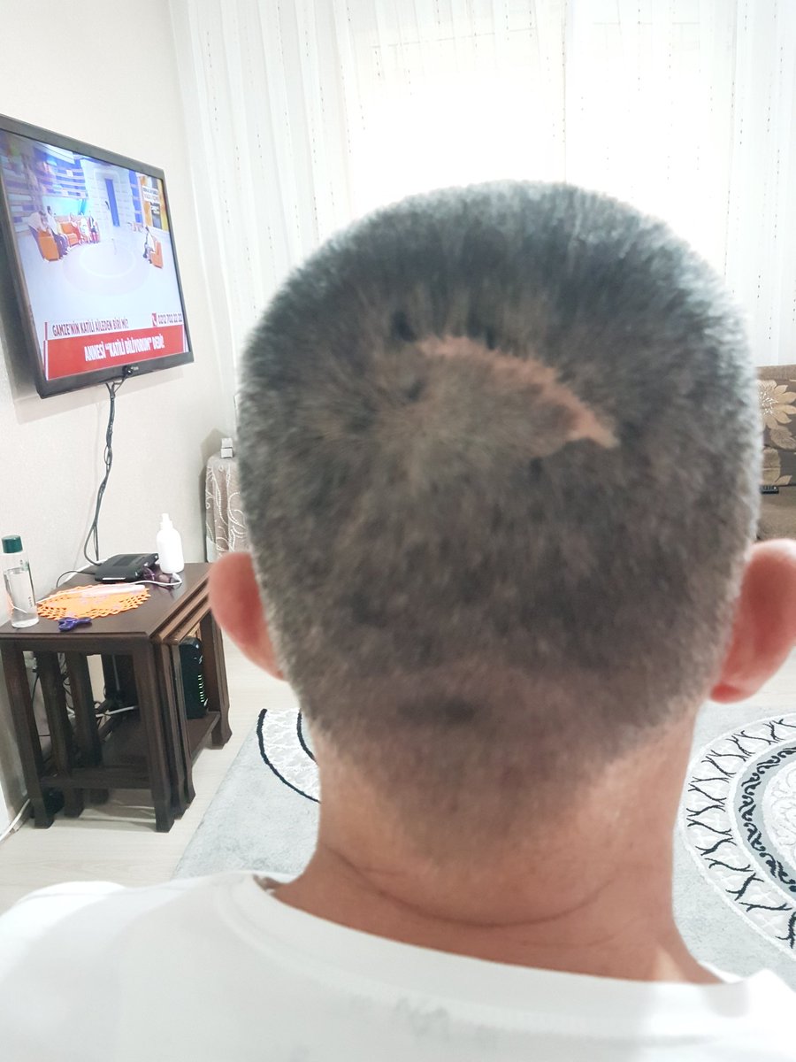 Terörlemucadelede yaralanmiş 20 bin asker yillardir madur olmusdur gazilik haklarini madalyalarini şeref ayligi bağlanmasi için kanun teklifi verildi meslisden geçmedi secimden öncen 20 bin kahramanlarin maduriyetleri giderilmesini istiyoruz