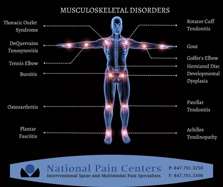 NationalPain's tweet photo. Musculoskeletal Disorders #MSK #TheRealDrJoshi #NationalPain #TailoredTreatments #MultiModal #PainManagement https://t.co/AtMpo5SXW8