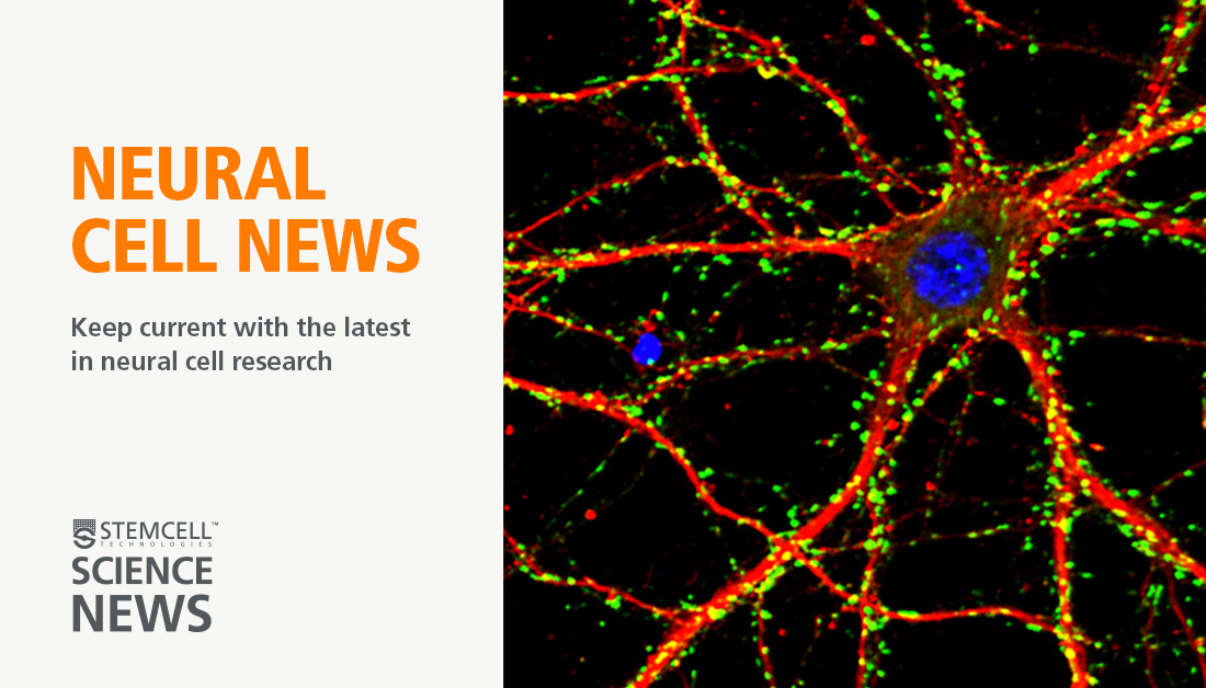 Attention #Neurotech22 attendees! Neural Cell News (@NeuralCell) summarizes the latest research, news, jobs, and events in neural cell research to help keep you stay up to date with your field. Learn more bit.ly/3vfOjdY